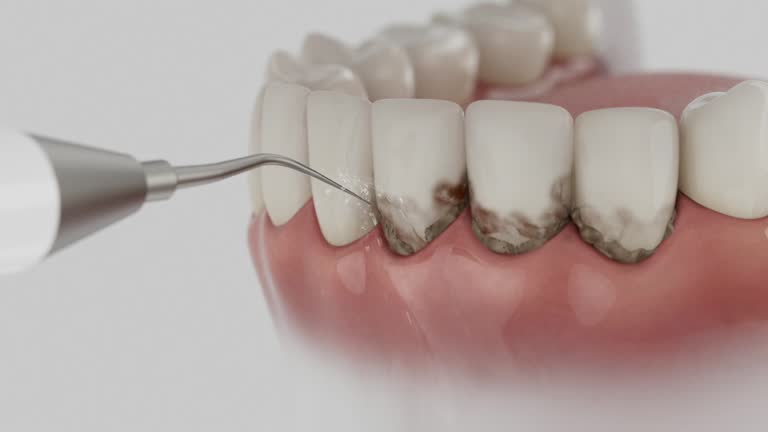 Reliable Dental Implants contractor in Vienna, WV by Smile Center Dentistry